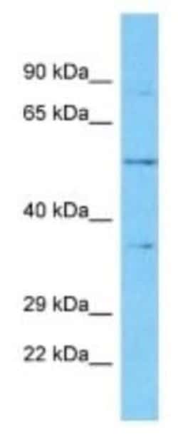 OR5K4 Rabbit anti-Human, Polyclonal, Novus Biologicals 100 &mu;g | Buy Online | Novus Biologicals | Fisher Scientific